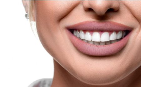 Achieve Your Dream Look: Hollywood Smile Makeover in Dubai