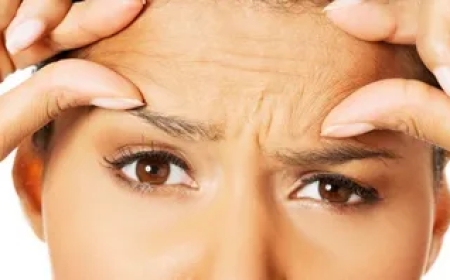 Lösungen gegen Stirnfalten: Natürliche Methoden zum Glätten