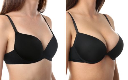 New Beauty Era with Breast Fillers Injections in Dubai