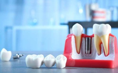 A Local Look at Smile Services in Llanelli