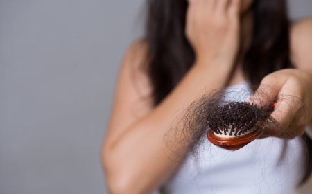 Cost of Hair Transplant in Islamabad: What Factors Affect It?