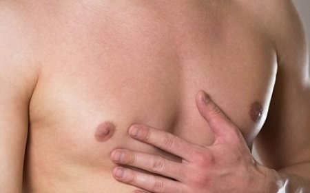 Best Ways to Diagnose Gynecomastia at Home
