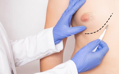 Treating One-Sided Gynecomastia: Is Surgery Different?