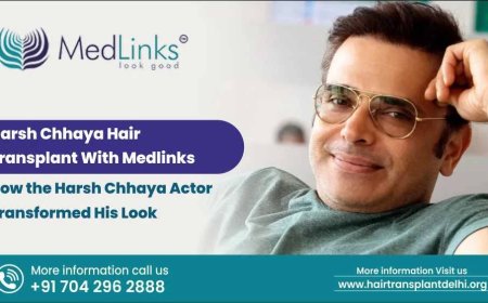 Harsh Chhaya Hair Transplant With MedLinks: A Subtle Yet Striking Transformation