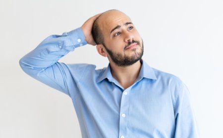 Hair Fall Causes in Men: Know Why It's Happening