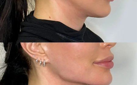 Get the Defined Jawline You’ve Always Wanted with the Best Plastic Surgeons in Dubai