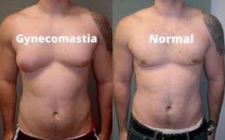 Top Clinics for Male Breast Reduction in Islamabad