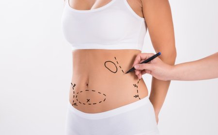 Abdominoplasty for Men in Islamabad: Growing Trend Explained