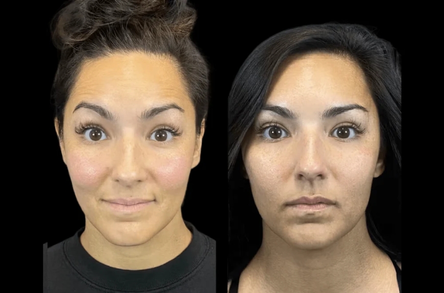 Why Expats Trust the Best Aesthetic Clinic in Dubai for Consistent Care