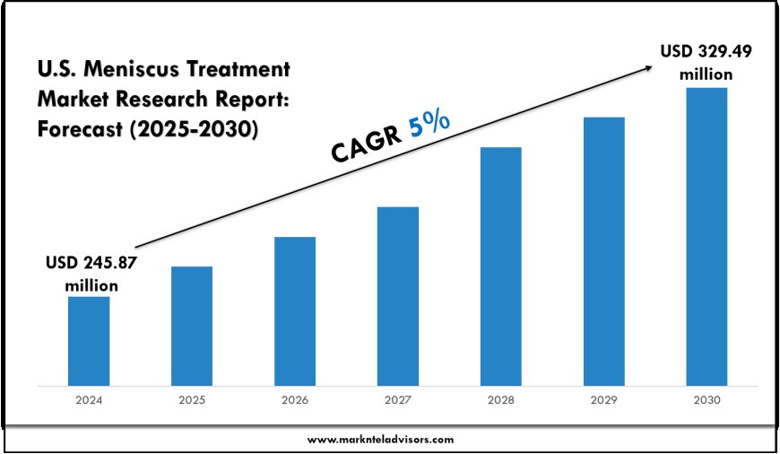 U.S. Meniscus Treatment Market Share, Value & Industry Trends
