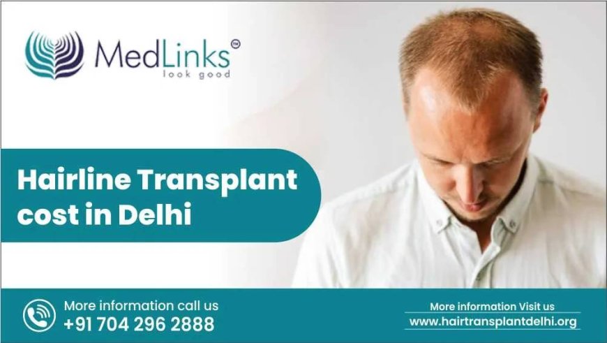Hairline Transplant Cost in Delhi: What You Need to Know