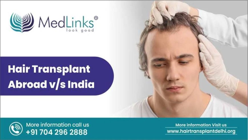 Hair Transplant Abroad vs India: Which Is the Better Choice?