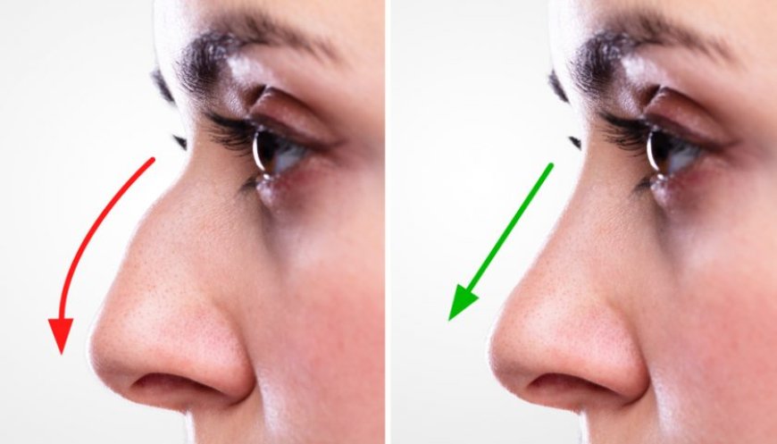 Why Patients Are Searching for the Best Rhinoplasty in Islamabad